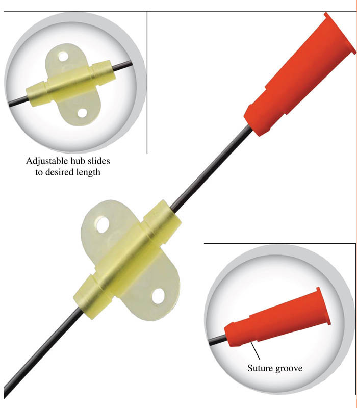 CATHETER, TOMCAT, KAT KATH, 3.5FR X 14CM, I.V. Catheters